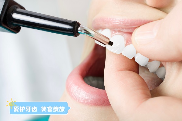牙齿美白