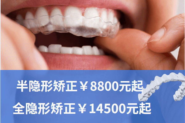 4B987CF3-1E60-4b89-96C6-2607D27F9ADA.png