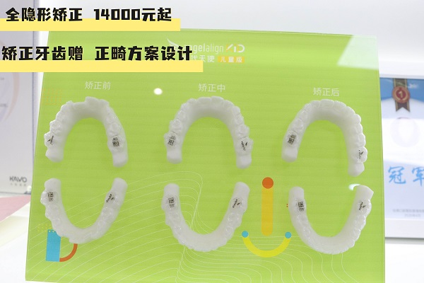 隐形矫正