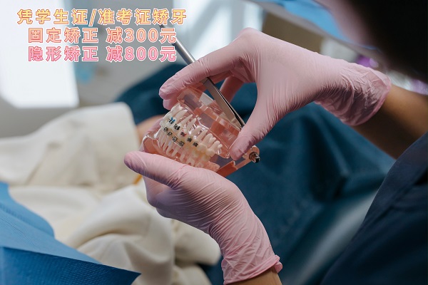 牙齿矫正
