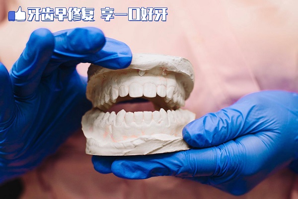 牙齿修复