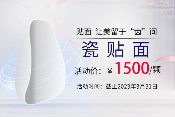 合肥瓷贴面