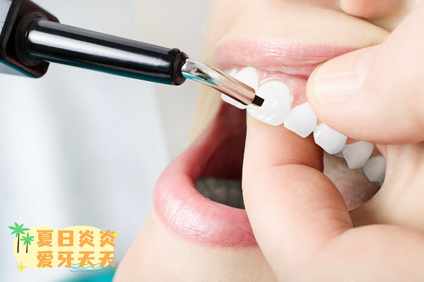 洗牙