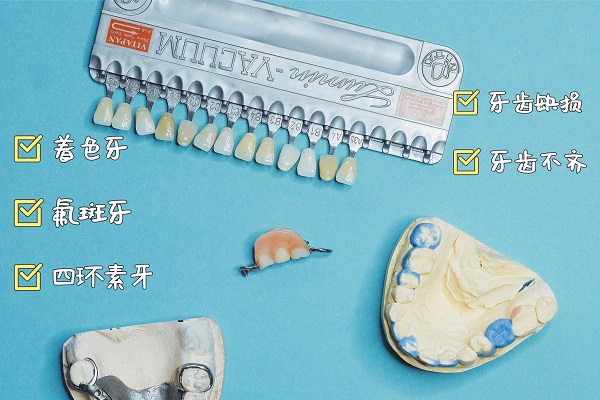 瓷贴面