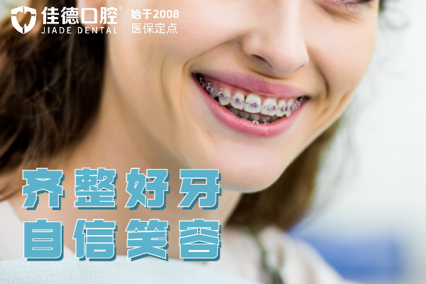 自定义模板.jpg